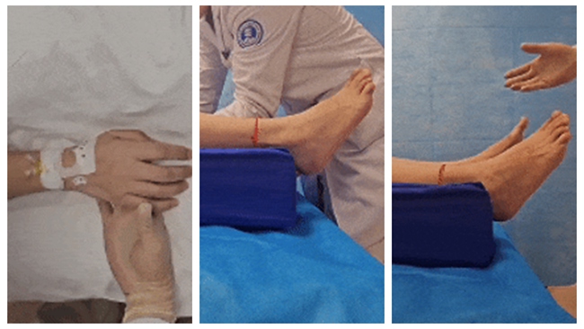 電刺激6小時(shí)后患者恢復(fù)情況。